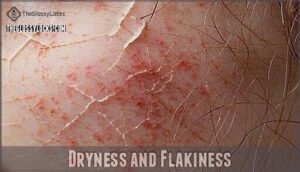 dryness and flakiness