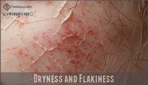 dryness and flakiness