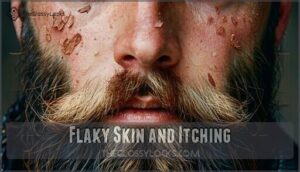 flaky skin and itching