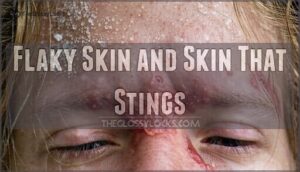 flaky skin and skin that stings