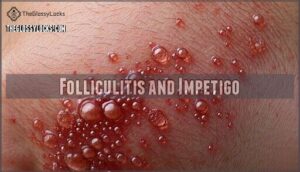 folliculitis and impetigo