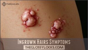 ingrown hairs symptoms