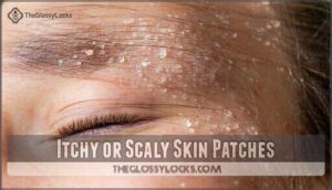 itchy or scaly skin patches