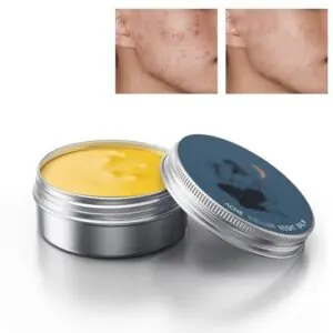 Organics Acne Balm, Acne and B0DBLNDZMP
