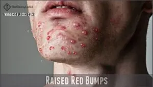 raised red bumps