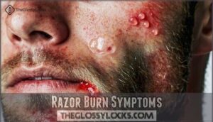 razor burn symptoms