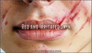 red and irritated skin red and irritated skin