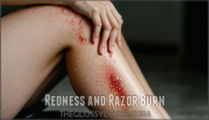 redness and razor burn redness and razor burn