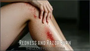 redness and razor burn