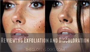 reviewing exfoliation and discoloration