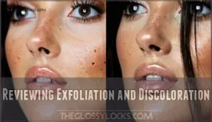 reviewing exfoliation and discoloration reviewing exfoliation and discoloration