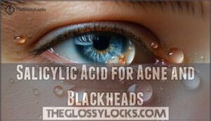 salicylic acid for acne and blackheads