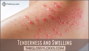 tenderness and swelling