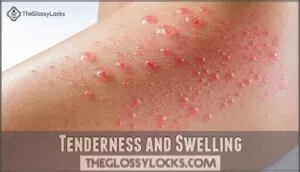 tenderness and swelling tenderness and swelling