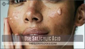 use salicylic acid use salicylic acid