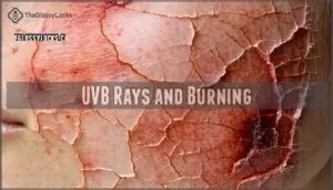 uvb rays and burning