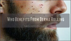 who benefits from derma rolling