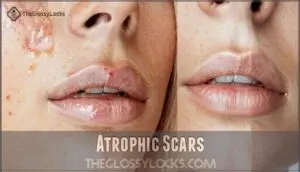 atrophic scars