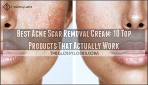 best acne scar removal cream