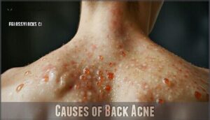 causes of back acne