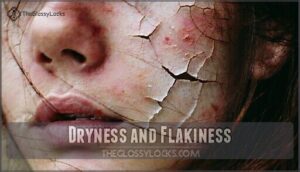 dryness and flakiness