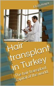 Hair transplant in Turkey: The B09SCXJLKH
