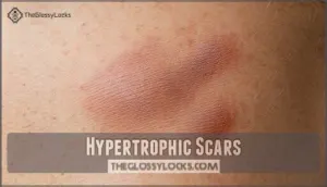 hypertrophic scars hypertrophic scars
