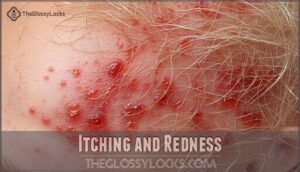 itching and redness