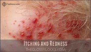 itching and redness itching and redness