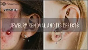 jewelry removal and its effects