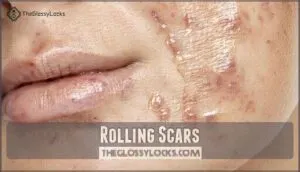 rolling scars