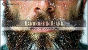 dandruff in beard