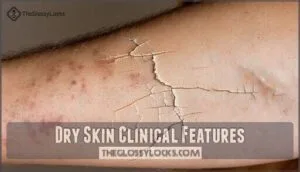 dry skin clinical features