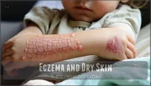 eczema and dry skin