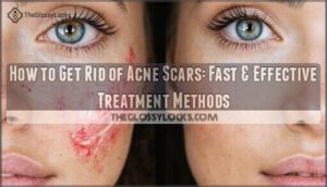 how to get rid of acne scars