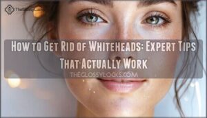 how to get rid of whiteheads