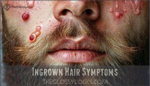ingrown hair symptoms