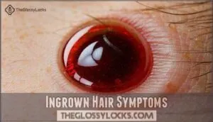 ingrown hair symptoms