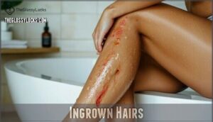 ingrown hairs