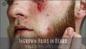 ingrown hairs in beard