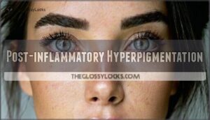 post-inflammatory hyperpigmentation