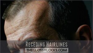 receding hairlines