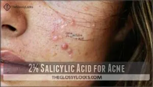 2% salicylic acid for acne