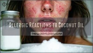 allergic reactions to coconut oil