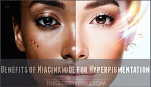 benefits of niacinamide for hyperpigmentation