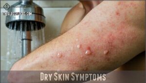 dry skin symptoms