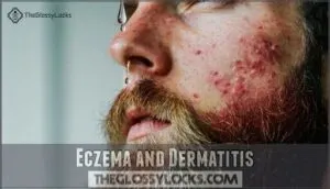 eczema and dermatitis