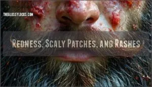 redness, scaly patches, and rashes redness, scaly patches, and rashes