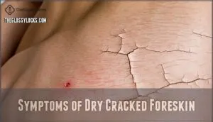 symptoms of dry cracked foreskin