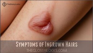 symptoms of ingrown hairs